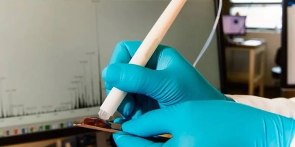 Trata-se de uma caneta que identifica tumores de forma imediata durante cirurgias de câncer, sem precisar de biópsia.