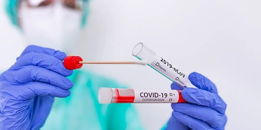 Desde o início da pandemia, Teixeira Soares tem 17 casos confirmados, 12 recuperados, 4 pessoas em recuperação e o município teve um óbito registrado pela doença.