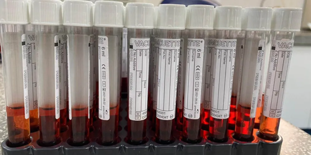Material foi elaborado pelo Centro de Produção e Pesquisa de Imunobiológicos (CPPI)