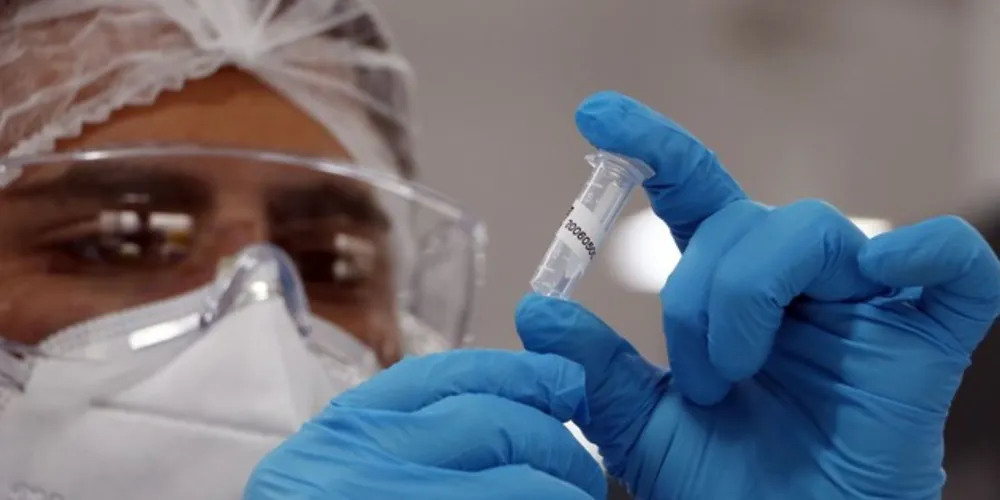 Número de óbitos por covid-19, no entanto, foi o menor desde maio