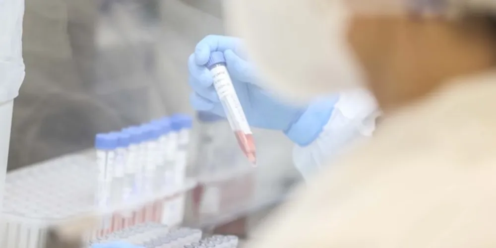 O Paraná também tem a melhor posição no Sul, região com os menores índices de incidência e óbito pela Covid-19.