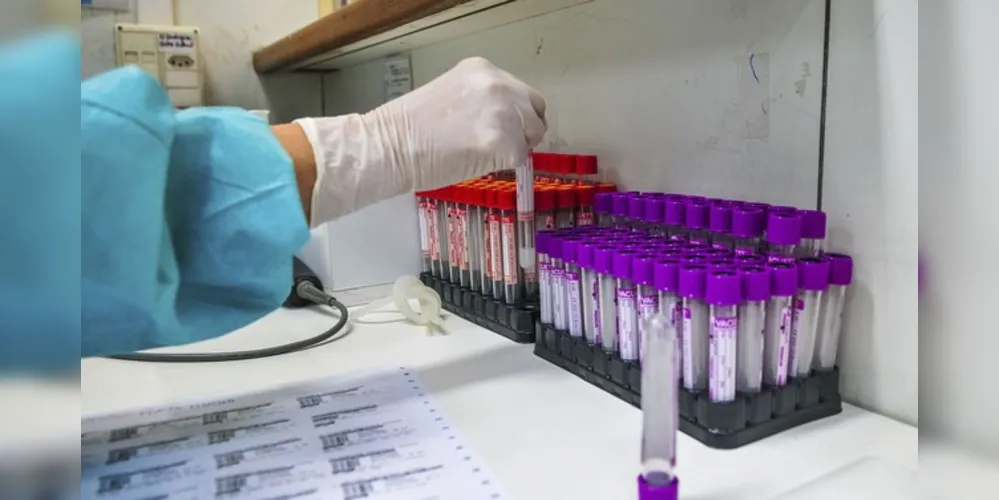 Em uma pesquisa online com 965 pacientes recuperados da infecção, 879 pessoas, o equivalente a 91,1%, responderam que estavam sofrendo pelo menos um efeito colateral da doença.