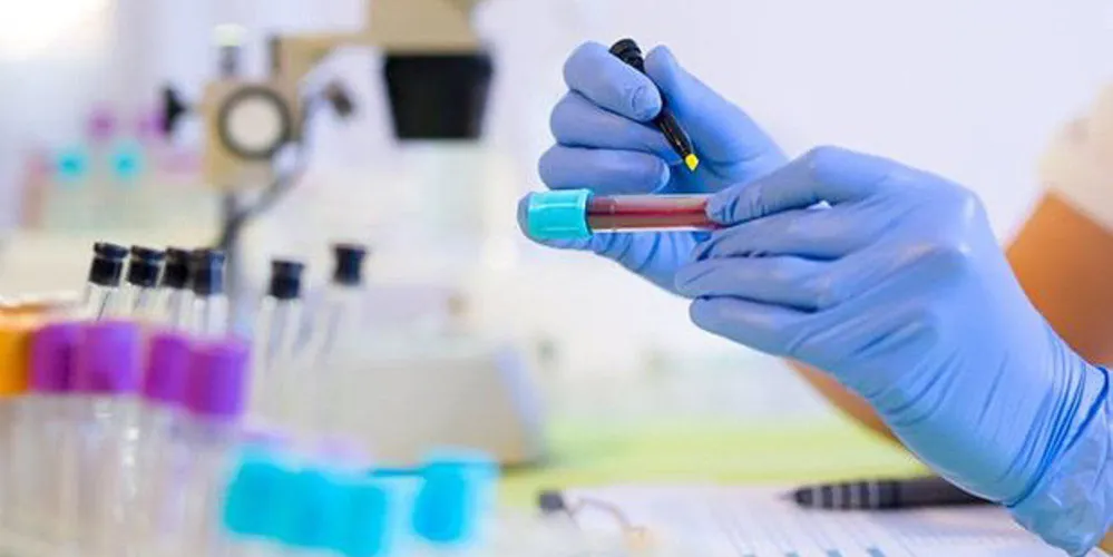 Drive thru teve testes rápidos para detecção da covid-19 com valores diferenciados