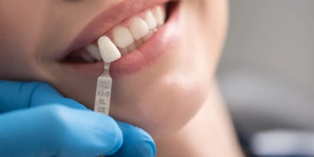 Mulher cria vaquinha para fazer implante dentário.