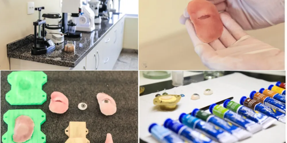 A equipe da UTFPR desenvolveu um método de criação de próteses faciais usando digitalização e modelagem no computador, a partir do caso de cada paciente.