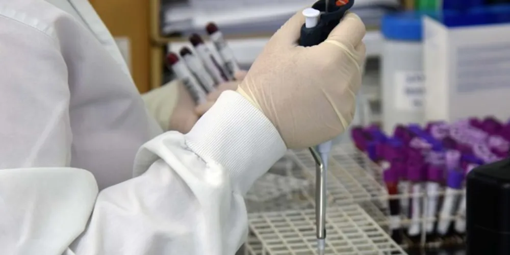 Nova ampliação se dá pela parceria da Secretaria da Saúde com o IBMP e reforço no Laboratório Central do Estado.