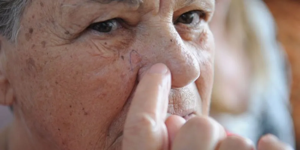 Em 2019, foram 210.032 pedidos de biópsias para detecção do câncer de pele, entre janeiro e setembro.