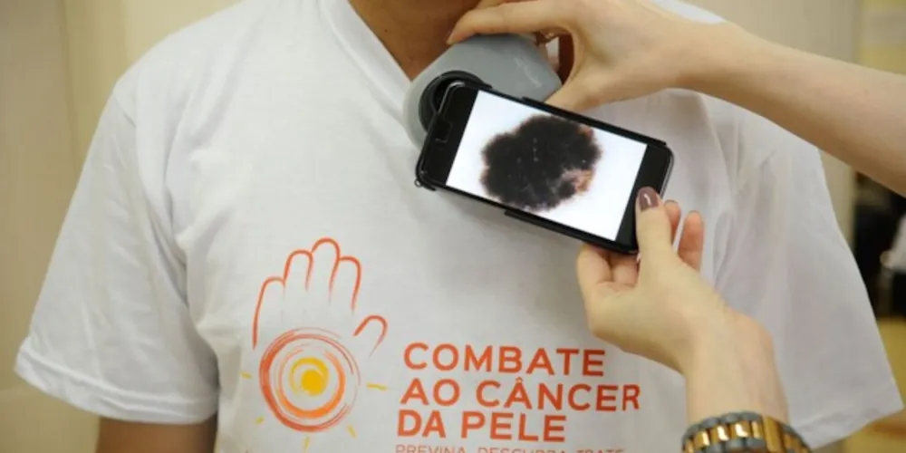 Dermatologista da Consaúde explicou os principais cuidados para evitar o câncer
