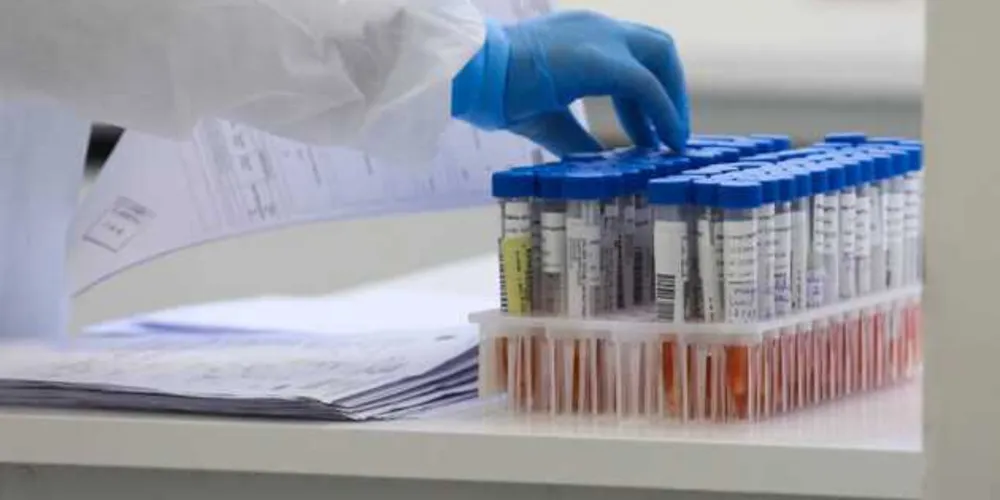 Município soma 11.489 casos positivos da doença desde o início da pandemia
