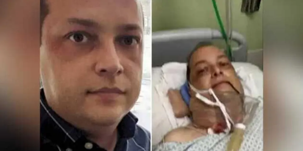 Portador da doença desde os 11 anos, ele hoje está internado e o tratamento se aproxima dos R$ 60 mil, muito acima do que a família pode bancar.