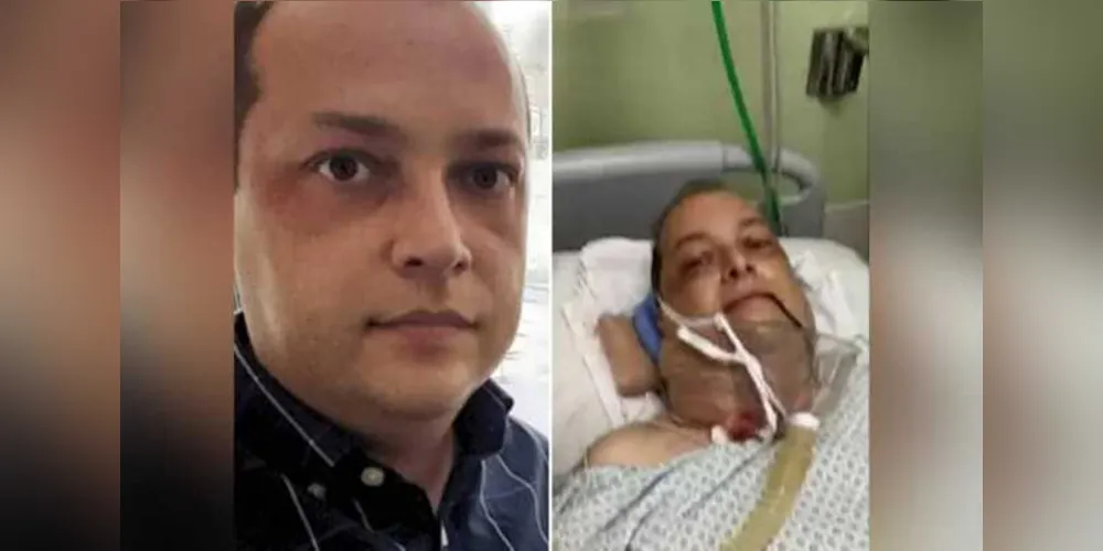 Portador da doença desde os 11 anos, ele hoje está internado e o tratamento se aproxima dos R$ 60 mil, muito acima do que a família pode bancar.