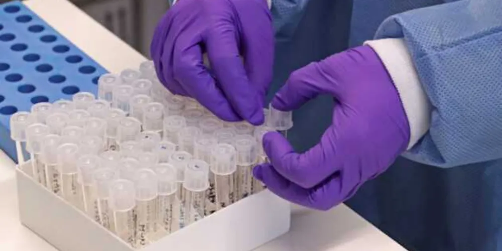 Novo boletim estadual foi divulgado na tarde desta quinta-feira (14)