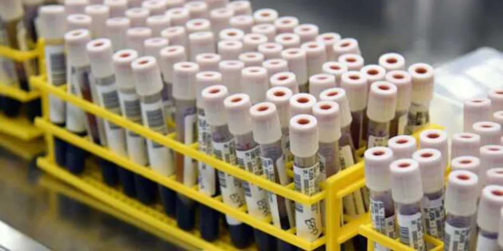 Imagem ilustrativa da imagem Saúde esclarece diferenças entre dengue e Covid
