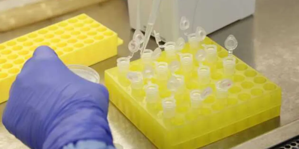 Números apontam que o Brasil já contabilizou 224 mil mortes pela doença. 