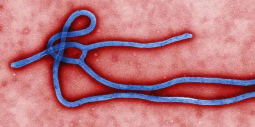 Esta é a primeira vez que a doença reaparece desde o pior surto de ebola no mundo, entre 2013 e 2016.