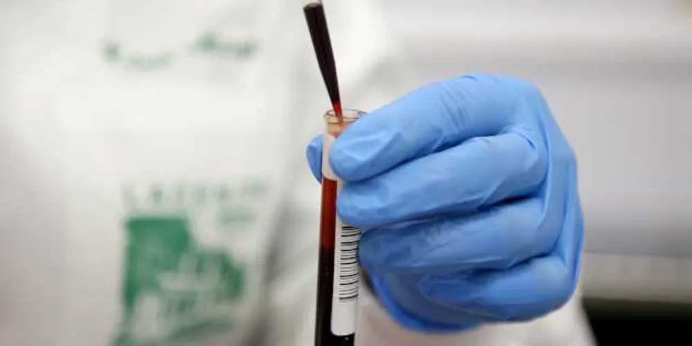 1.566 pacientes com diagnóstico confirmado de Covid-19 estão internados