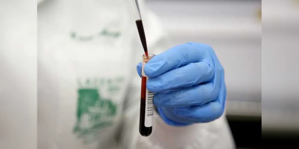 1.566 pacientes com diagnóstico confirmado de Covid-19 estão internados