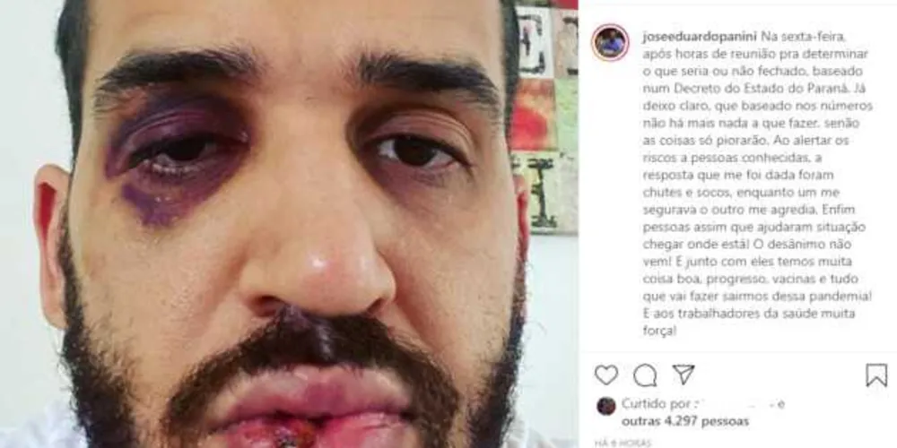 O profissional da saúde publicou a foto do rosto machucado em uma rede social 