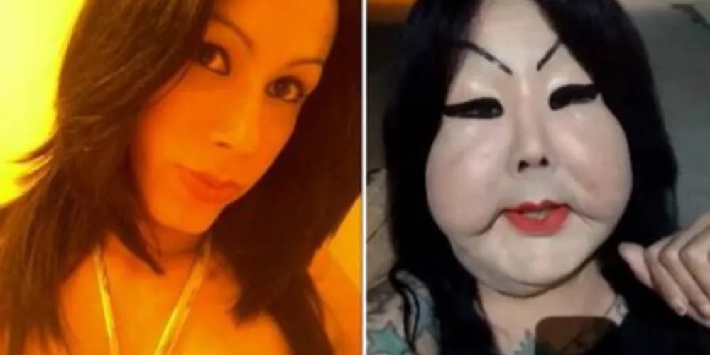 Imagem ilustrativa da imagem Trans 'Fofão' doa R$ 20 mil e desiste de operação