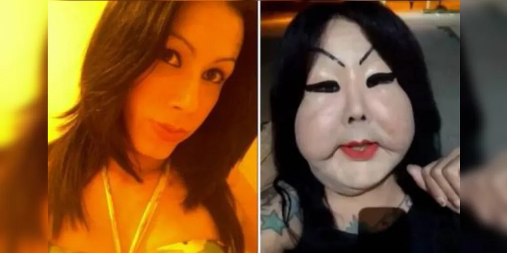Imagem ilustrativa da imagem Trans 'Fofão' doa R$ 20 mil e desiste de operação