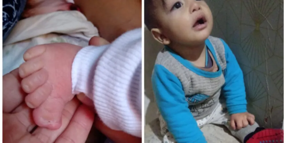 João tem oito meses e precisa fazer a cirurgia antes de completar um ano.
