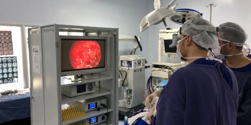 Acesso ao tumor localizado no cérebro é feito pelo nariz utilizando um sistema de vídeo em técnica minimamente invasiva