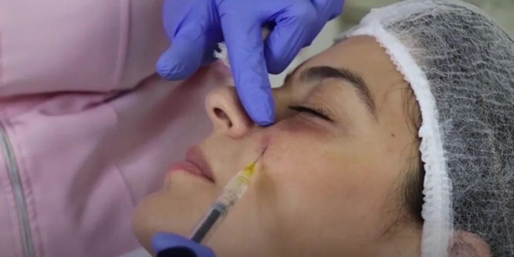 Na foto, Lolô Mongruel em procedimento para redução de olheiras