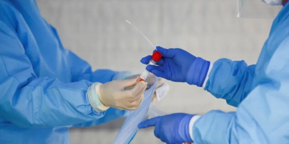 Nesta segunda (24), foram mais de 37 mil casos positivados.