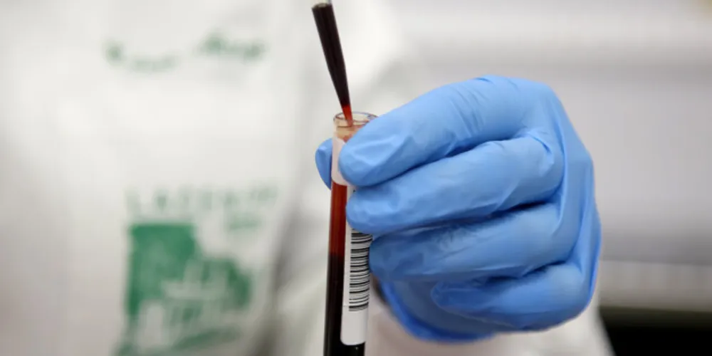 16.519 pessoas estão com o vírus ativo no corpo.