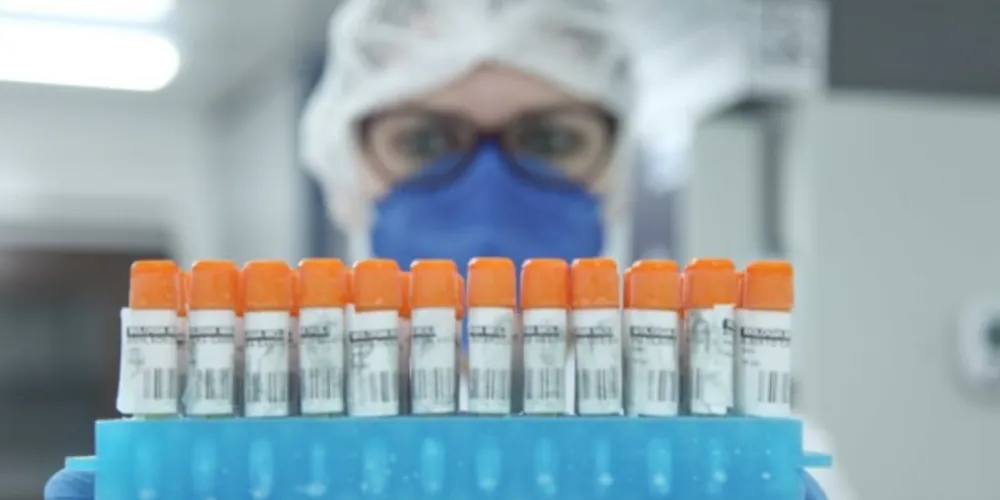 Para realizar o inquérito molecular das variantes, a equipe emprega a estratégia chamada ‘PCR em tempo real’