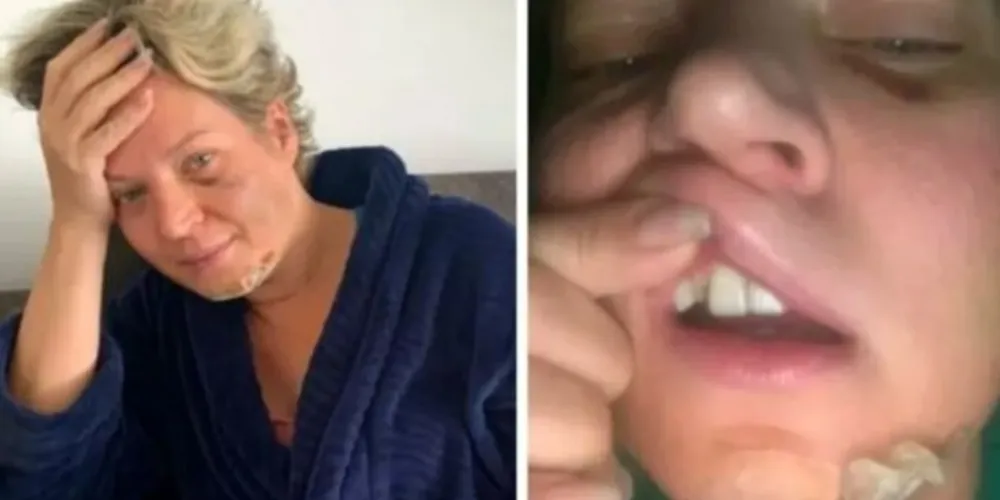 Ela estava em seu apartamento, em Brasília, e disse ter acordado em meio a uma poça de sangue no chão de seu closet