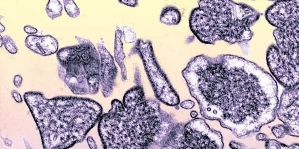 Patógeno tem letalidade de 50%, e pode ser transmitido pelo contato de animais contaminados ou pessoas infectadas.