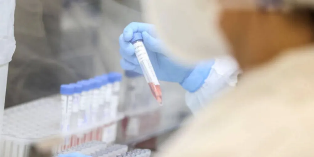 Novos casos foram registrados em 13 cidades do Paraná. Agora, o Estado soma 179 casos e 44 óbitos por causa desta variante.