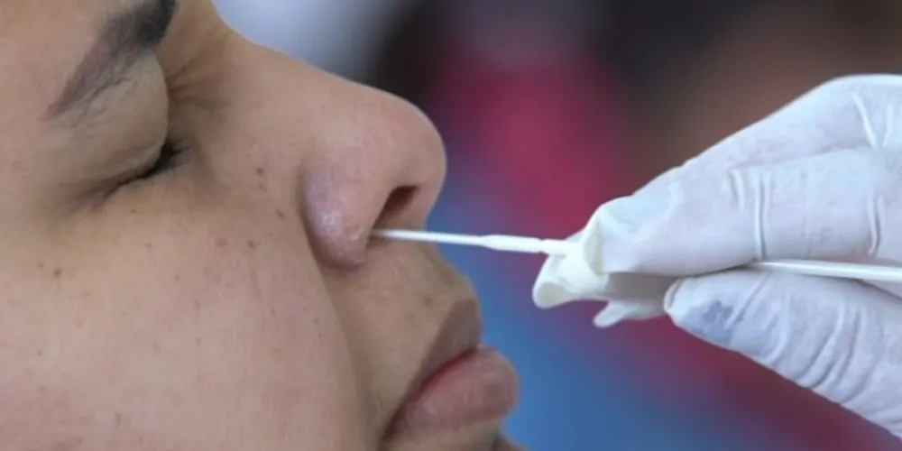 A dupla infecção, chamada de 'flurona', acontece quando o paciente testa positivo para Covid-19 e Influenza ao mesmo tempo