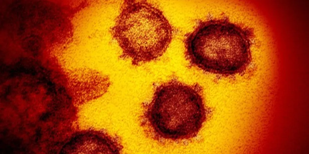 Imagem ilustrativa da imagem Brasil registra mais de 165 mil casos de covid em 24h