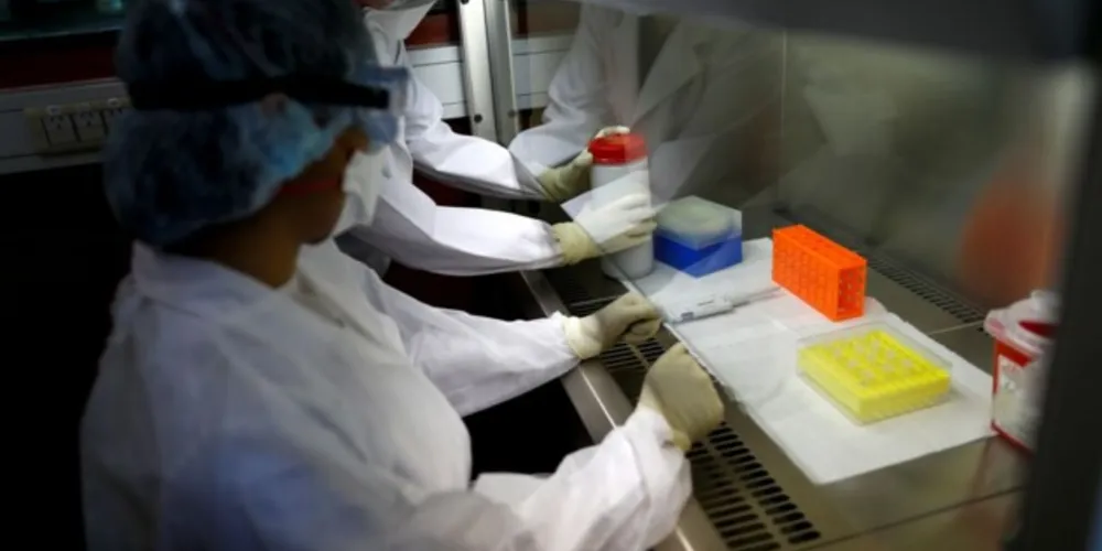 157.393 casos de covid-19 foram registrados nas últimas 24 horas 