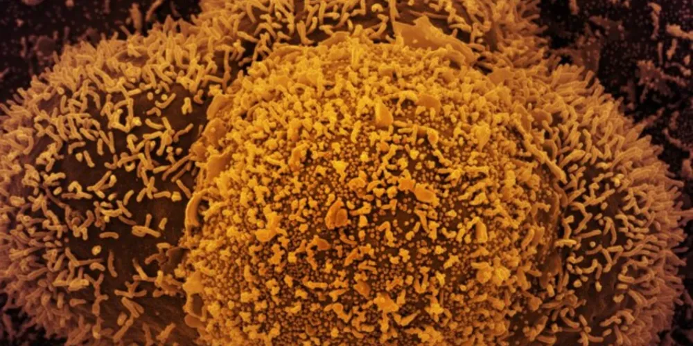 Última vítima foi uma mulher de 76 anos