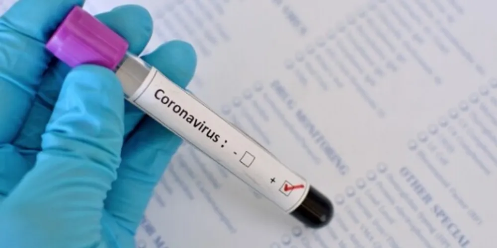 São 4.414 casos confirmados para Covid-19 em residentes de Palmeira