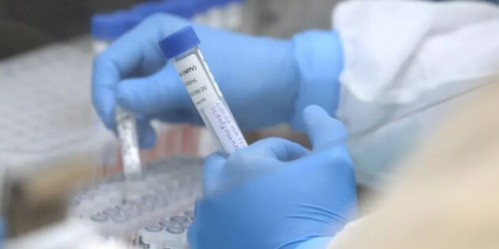 Nesta semana foram registrados 481 casos e 28 óbitos pela infecção da H3N2.