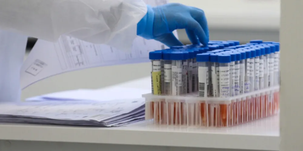 Agora, o Paraná soma 375 casos e quatro mortes pela doença, que é considerada um tipo do vírus Influenza A (H3)