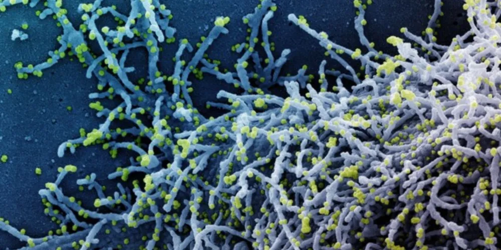 Tratamento demonstrou redução de até 78% nas hospitalizações e mortes.