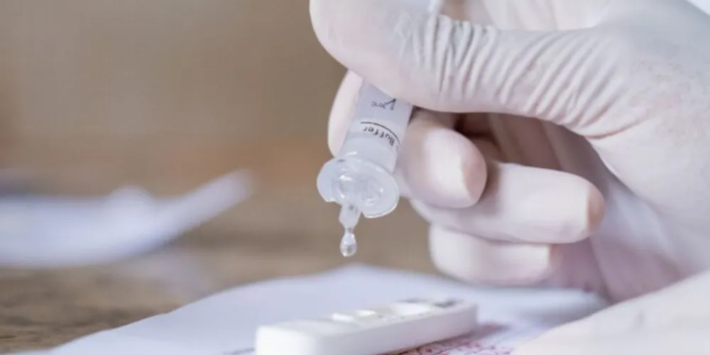 Testes rápidos de Covid estão incluídos nos planos de saúde