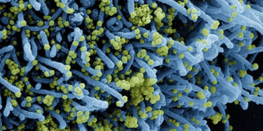 A nova variante apresenta um número extremamente alto de mutações.