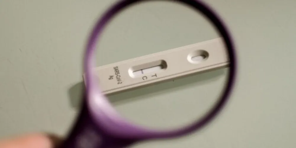 Anvisa aprova nova marca de autoteste para detectar covid-19
