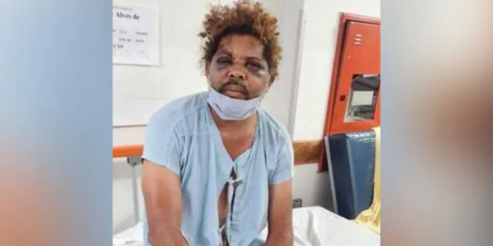 Morador de rua agredido por personal pede vaga em abrigo e teme represálias