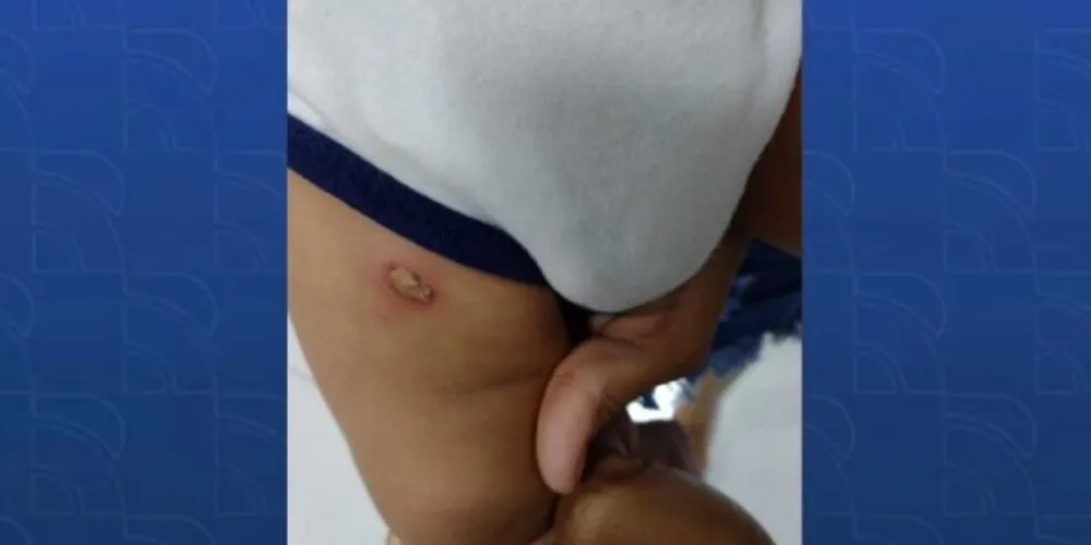 Segundo o delegado, foram encontrados ferimentos em uma das pernas da criança.