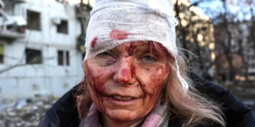 Mulher ucraniana foi alvo de mísseis russos