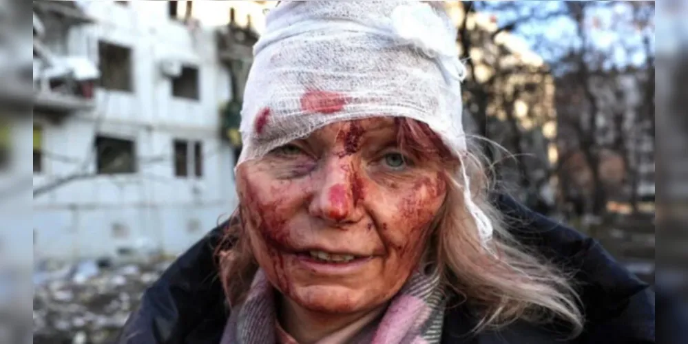 Mulher ucraniana foi alvo de mísseis russos