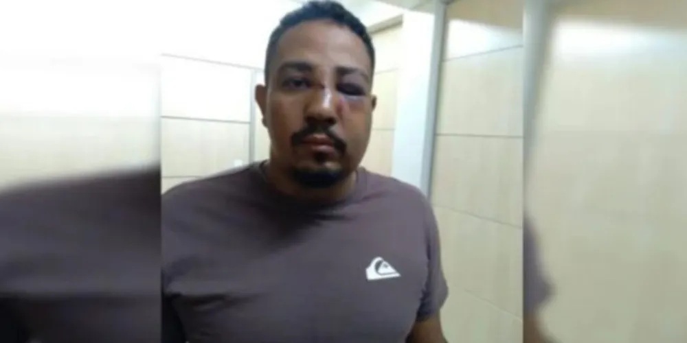 A vítima ficou com várias marcas da agressão no rosto e perdeu alguns dentes.