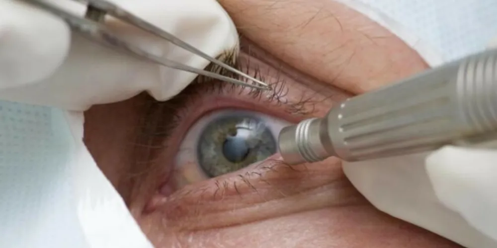 Abril Marrom educa as pessoas sobre doenças que podem acometer os olhos e ser detectadas preventivamente.